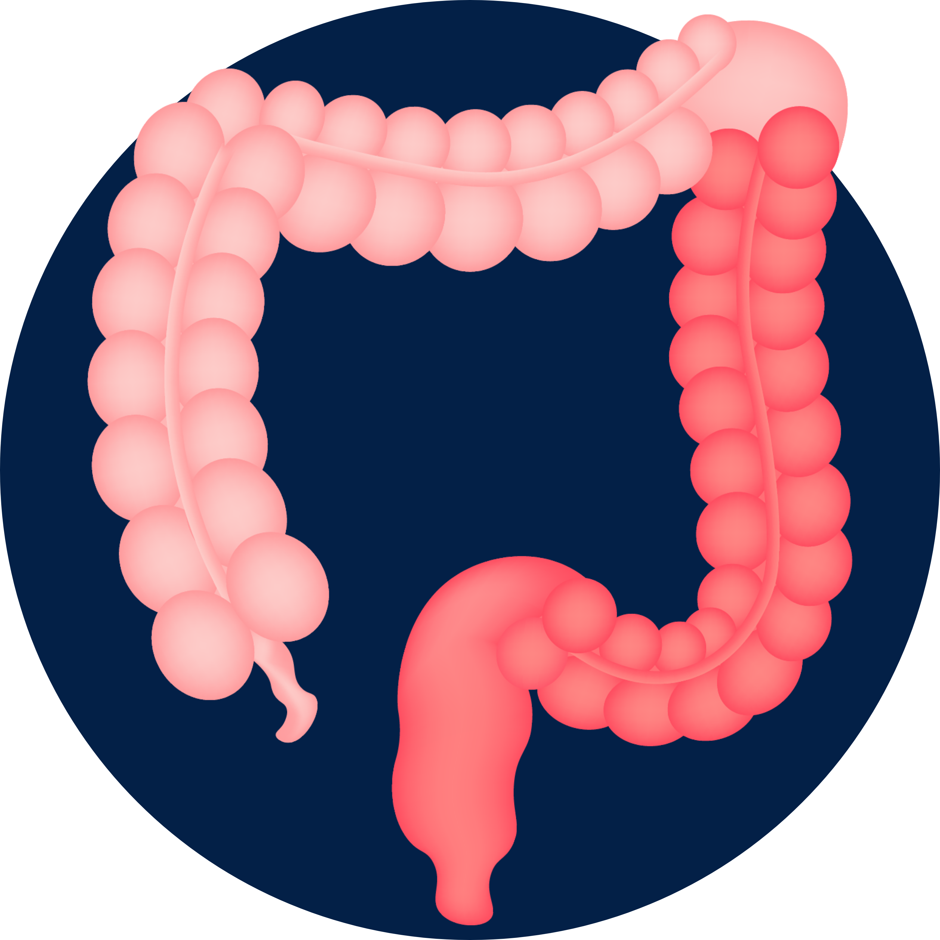 Controlling Ulcerative Colitis